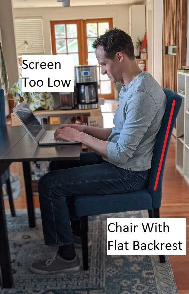 Forward Head Posture