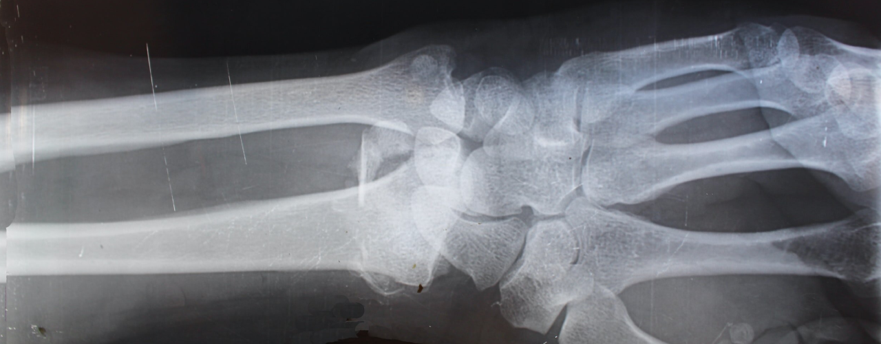 Diagnostic Imaging: X-ray vs. CT scan vs. MRI